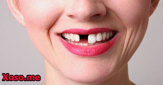 Mơ thấy rụng một chiếc răng