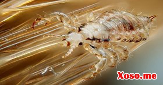 Mơ thấy ngồi gãi chấy - Giải mộng chiêm bao thấy ngồi gãi chấy